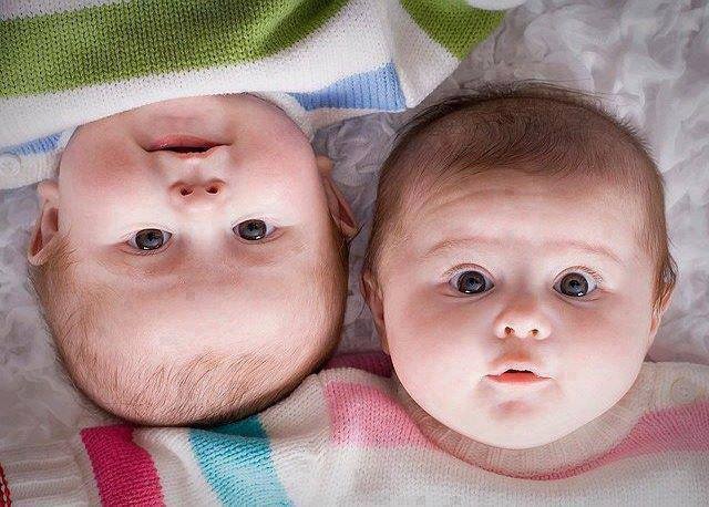Mẹo lưu ý với thóp của trẻ sơ sinh
